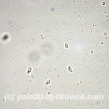 Wiciowce w powiększeniu 400 krotnym